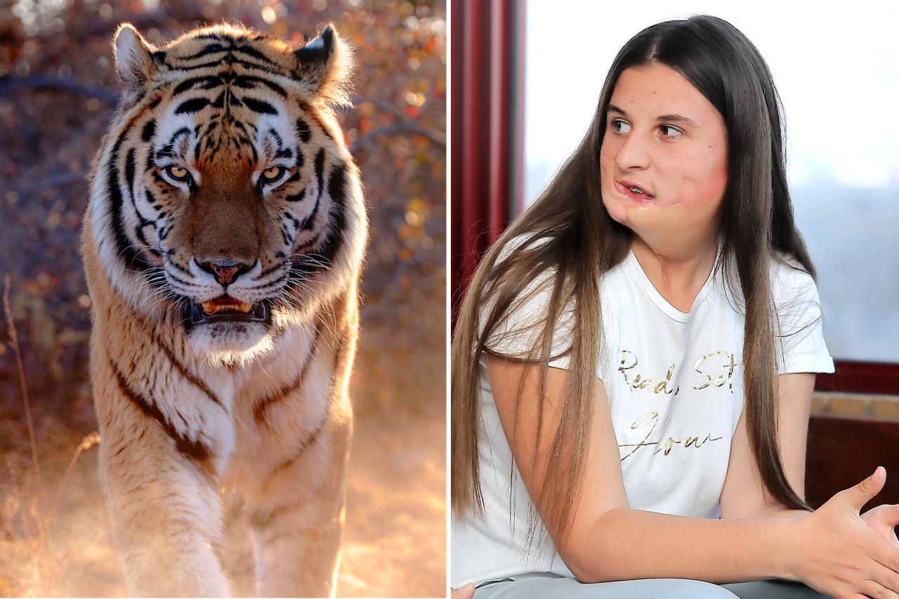 My face was ripped off by a tiger when I was a baby — but I love myself